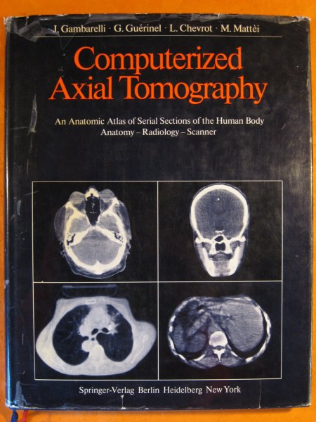 Computerized Axial Tomography: An Anatomic Atlas of Serial Sections of the Human Body. Anatomy, Radiology, Scanner Image for Computerized Axial Tomography: An Anatomic Atlas of Serial Sections of the Human Body. Anatomy, Radiology, Scanner